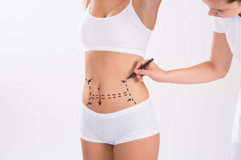 abdominoplastia-rio-de-janeiro