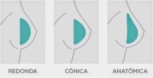cirurgia plastica para a protese de mama no rio de janeiro - rj